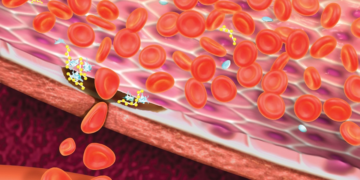 Bleeding Disorders Treatment Market Research: Include Steep Growth in the Development of The Industry