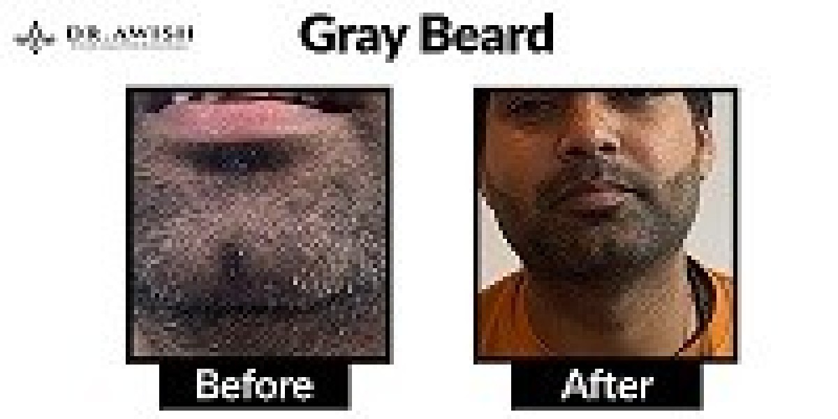 How to Reverse Grey Beard Naturally Simple Remedies